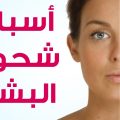 6290 2 علاج اصفرار الوجه - علاج شحوب الوجه واصفراره U16