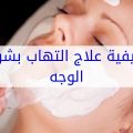 6467 3 علاج التهاب البشرة - كيفيه التخلص من التهابات الوجه غزول بدر
