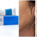 6292 3 منتجات التخلص من الجلد الميت - كريم لتقشير الوجه U16
